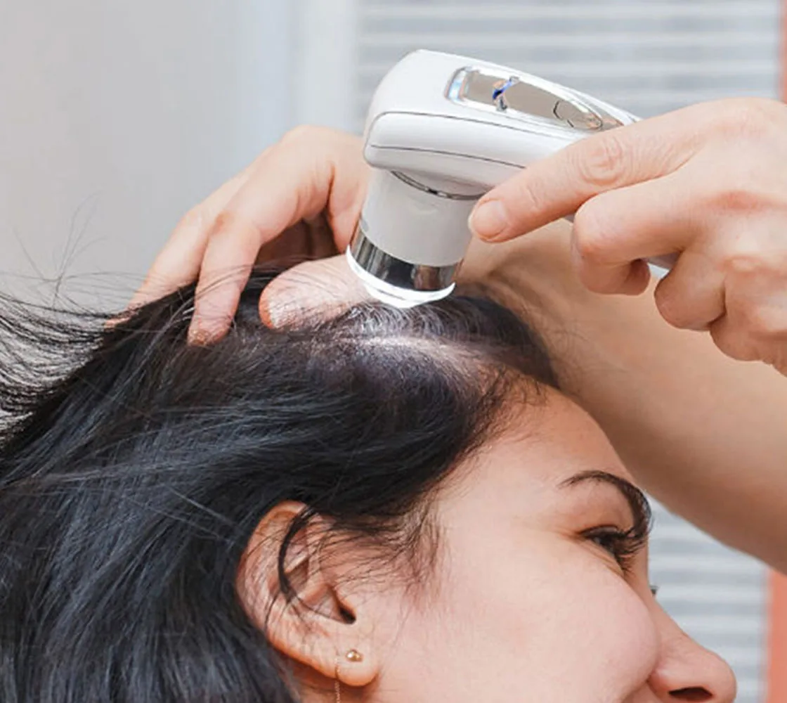 Scalp analysis with a magnifying device before exosome hair treatment