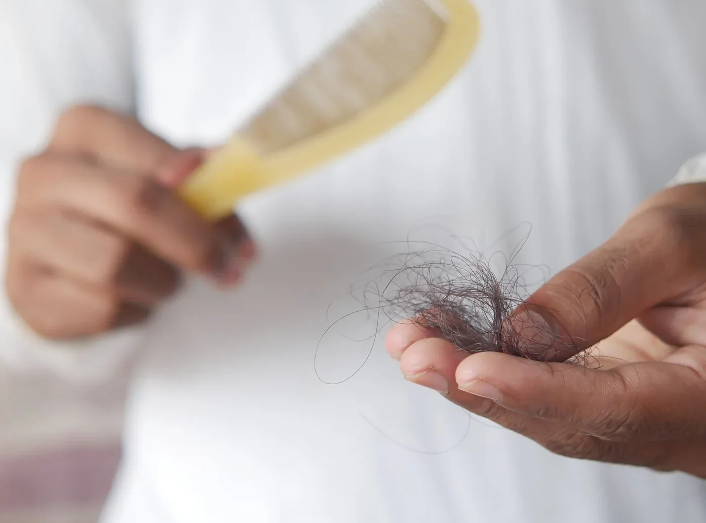 Woman holding a comb with fallen hair strands — hair fall treatment