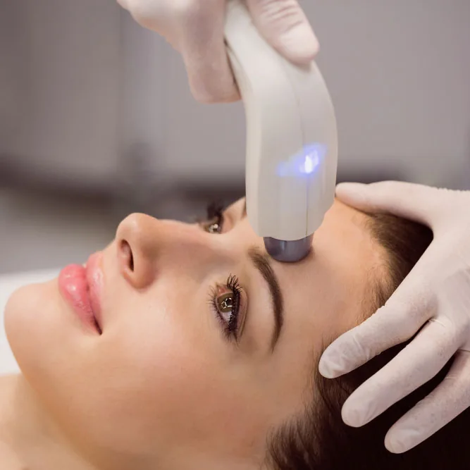 Woman receiving laser hair reduction on her face with protective goggles