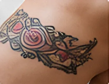 Colourful tattoo on the skin before laser tattoo removal