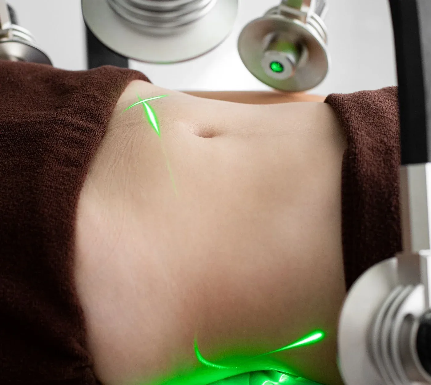 Lipo laser pads placed on a woman’s abdomen for body contouring