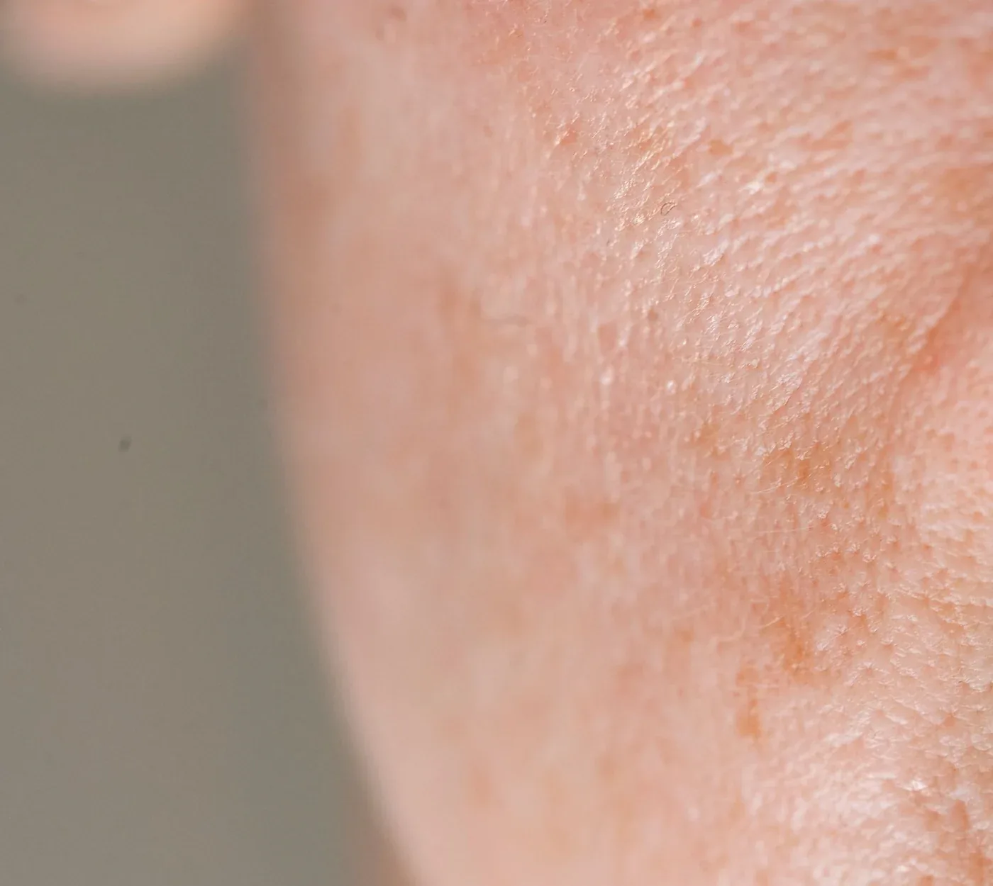 Close-up of skin texture and visible pores on the cheek